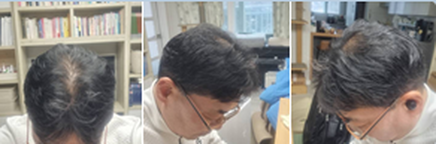 使用前后对比 2