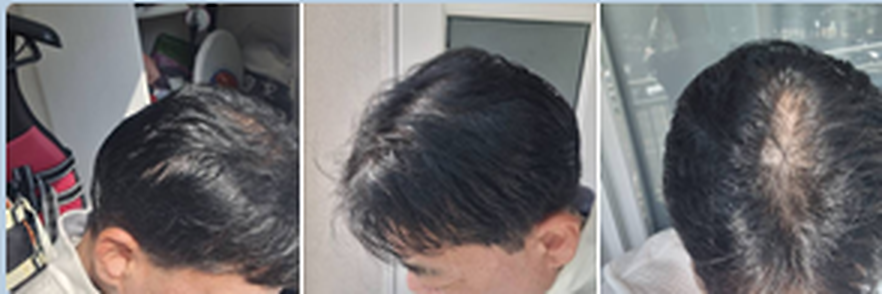 使用前后对比 3